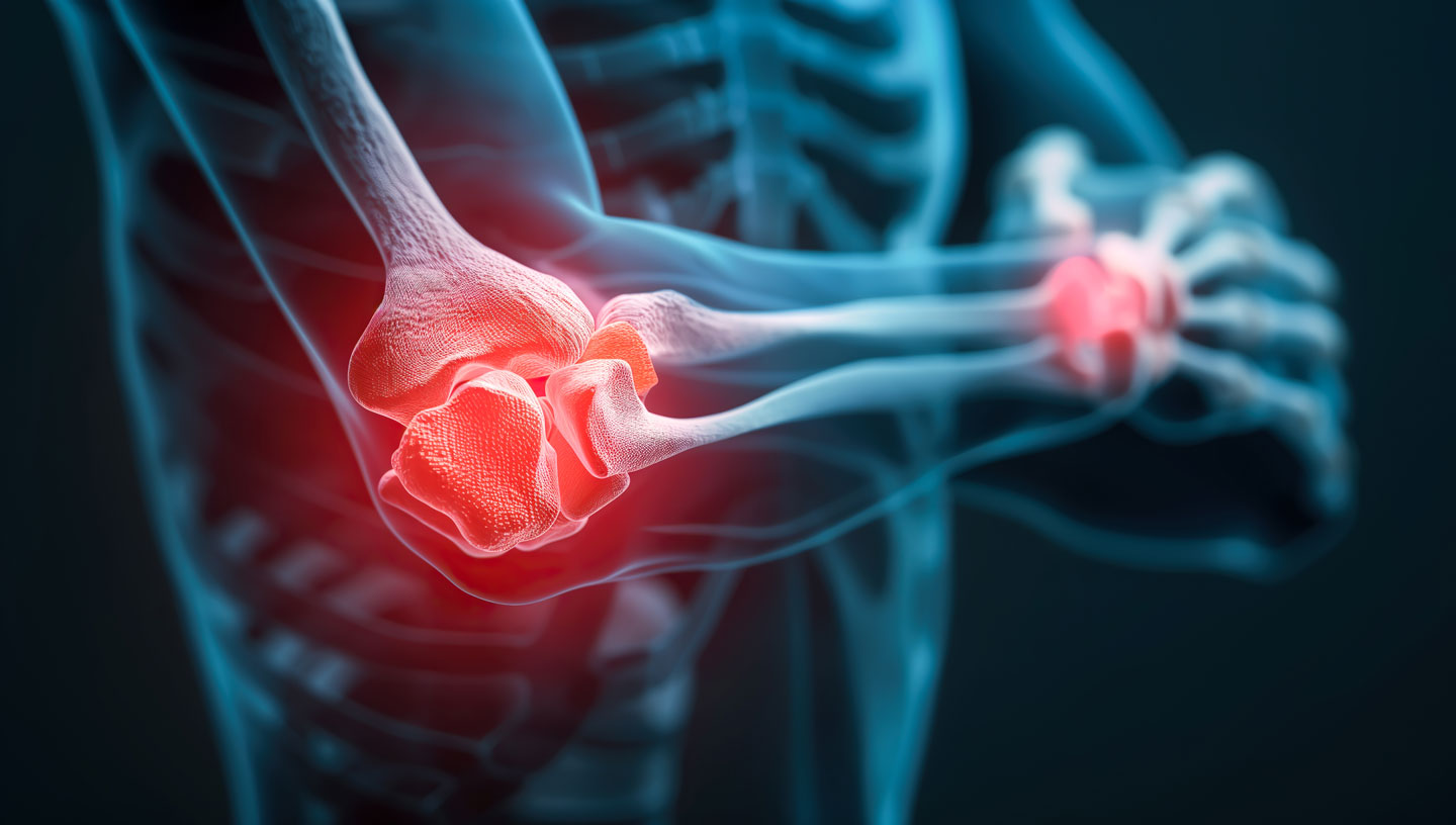 Elbow & Wrist Pain